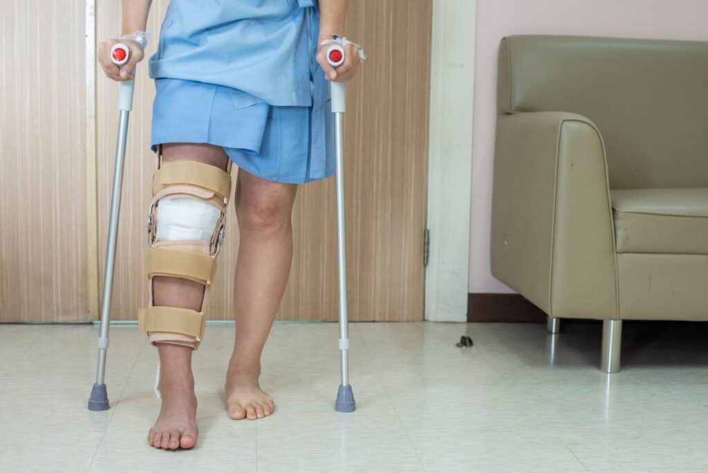 ACL Injury Treatment Dubai: Effective Rehabilitation After Knee Injury