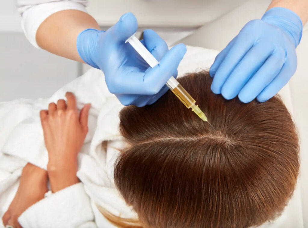 Why Prp Hair Treatment in Dubai and Hair Transplant in Dubai Remains a Trusted Hair Solution