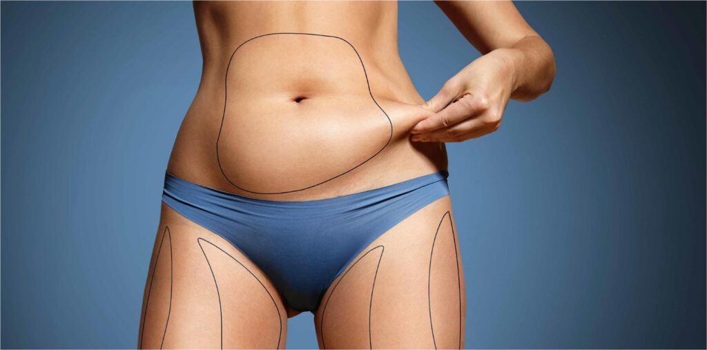 What to Expect from the Best Abdominoplasty Dubai Procedure