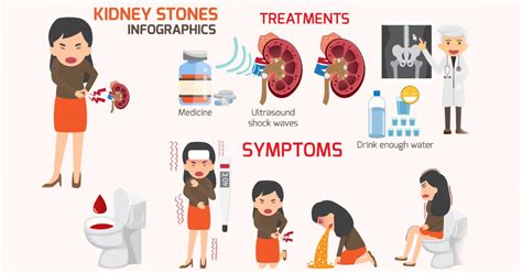 9 Signs Your Kidney Stone May Need Surgery Instead of Medication