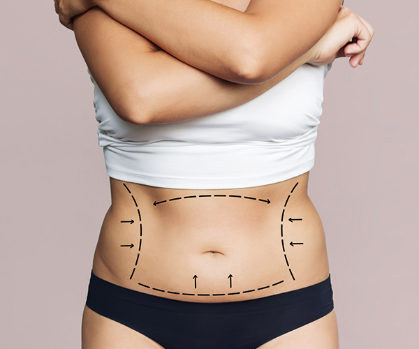 Best Tummy Tuck Dubai: How to Choose the Right Procedure for Your Needs