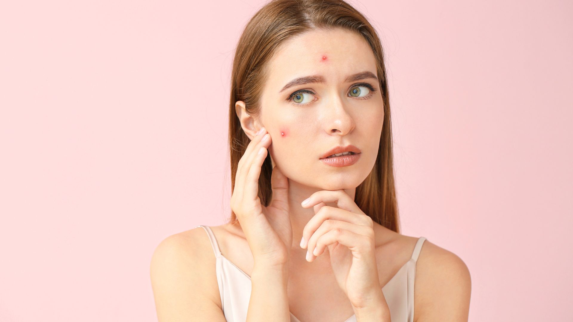 Acne Treatment in Dubai: How to Prepare for Your First Consultation