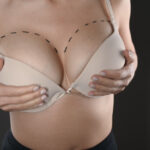 Breast Augmentation Dubai: How Can Results Be Planned for Different Body Types?