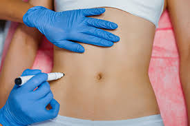 Intimate Area Fillers Dubai