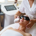Melasma Treatment in Manchester