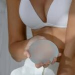 Augmentation mammaire à Paris : Choisir le volume et la forme les plus adaptés