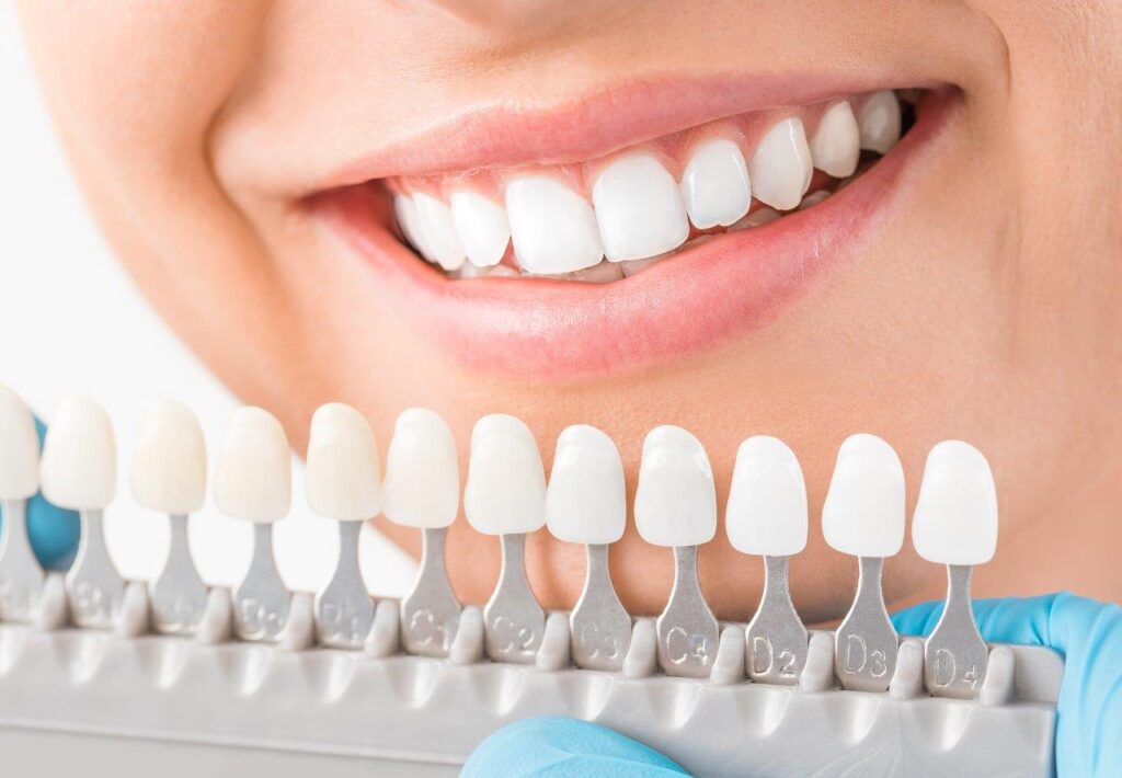 Veneers Dubai: How Are Tooth Shape and Smile Proportions Evaluated Before Treatment?